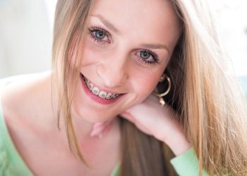 “Transforming Smiles: A Comprehensive Guide to Orthodontic Treatment”