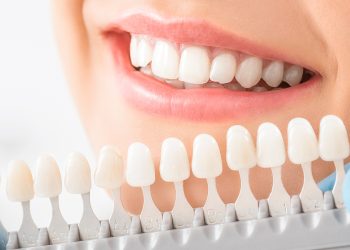 The Art and Science of Teeth Whitening: A Comprehensive Guide