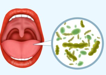 The source and solution of bad breath: regain fresh breath