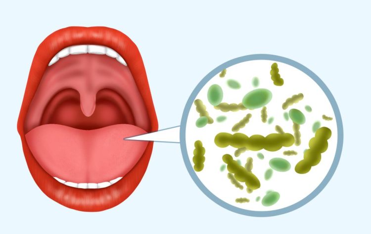 The source and solution of bad breath: regain fresh breath