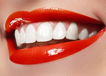 Safety considerations for teeth whitening: Beauty should not come at the cost of health