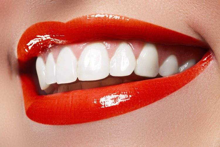 Safety considerations for teeth whitening: Beauty should not come at the cost of health