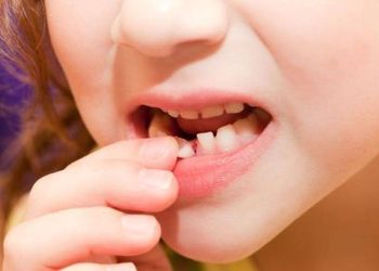 Emergency treatment and longterm management of loose teeth: stabilizing your teeth