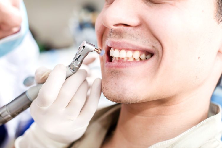 The Intricacies of Dental Cleaning: A Delicate Balance Between Health and Aesthetics