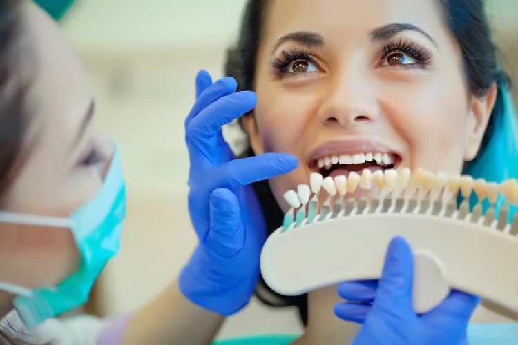 The Art of Teeth Whitening: Methods and Suitable Candidates