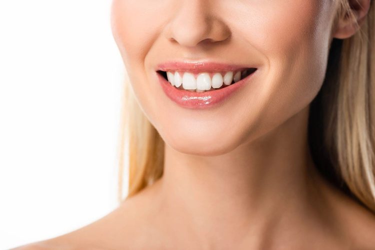 The Advantages of Dental Veneers Over Porcelain Crowns