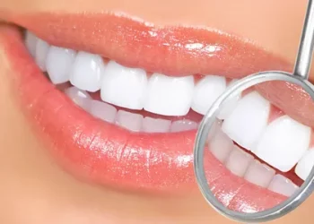 Prevention of Teeth Discoloration and Yellowing