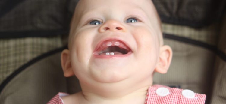 Do Milk Teeth Need to Be Treated for Cavities?