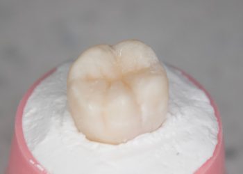 Dental resin filling: Principles, procedures and precautions