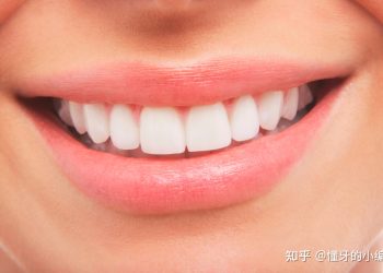 Teeth beauty Guide: From daily care to professional whitening, create a shining smile
