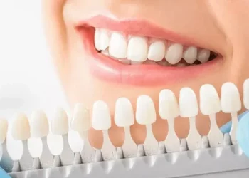 Dental Restoration: A Comprehensive Guide to Techniques, Methods, Processes, and Aftercare