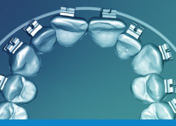Digital Orthodontic Technology: Leading the New Era of Oral Healthcare