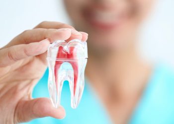 Root Canal Treatment: A Comprehensive Guide on Procedure, Techniques, and Aftercare