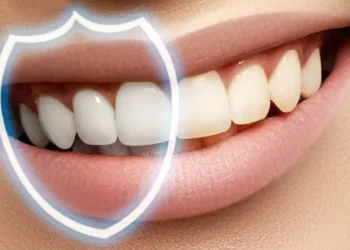 Teeth Whitening with Cold Light: Application and Development