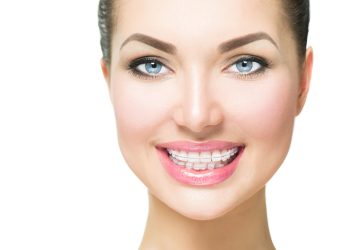 Which Orthodontic Technique Is Most Effective?