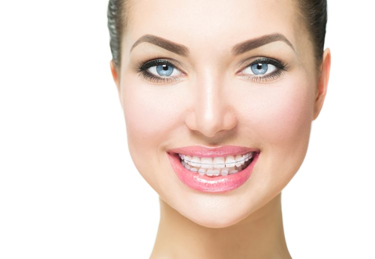 Which Orthodontic Technique Is Most Effective?