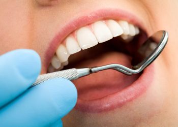 Can a Broken Tooth Be Saved? Here’s What Dentists Say!