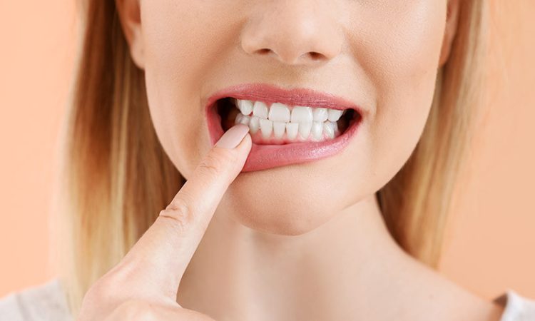 How to prevent periodontitis ?