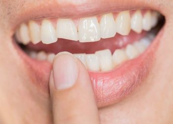 What Should I Do If My Tooth Chips? Simple and Effective Repair Methods!