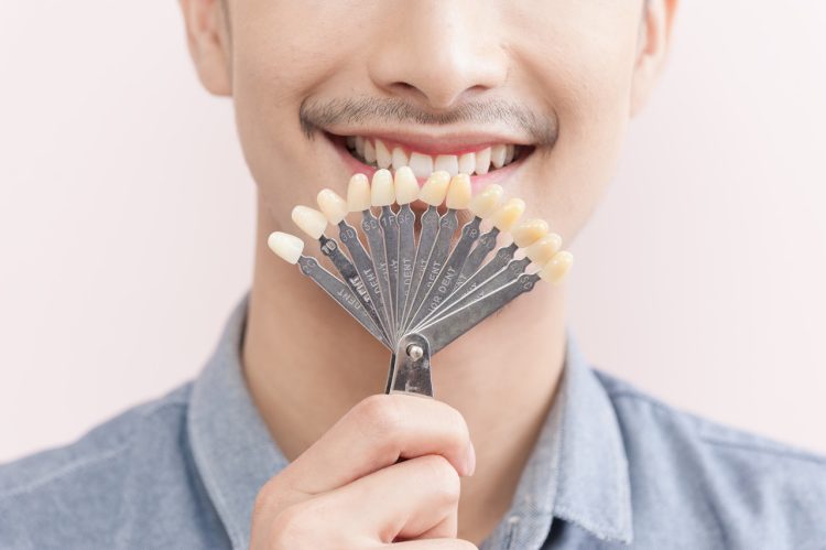 Can Dental Veneers Fix Tooth Imperfections? Who Are They Suitable For?
