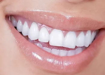 What Are the Most Popular Cosmetic Dental Procedures to Enhance Your Smile?