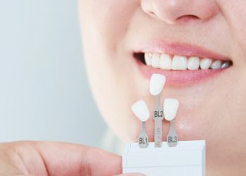 How Long Do the Effects of Cosmetic Dental Procedures, Such as Adhesives or Crowns, Typically Last?