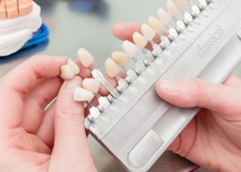 What Should You Expect During a Cosmetic Dental Consultation? How to Determine the Best Treatment for Your Needs?