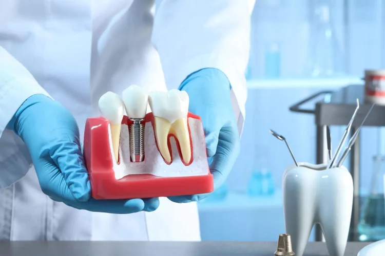Are There Specific Vitamins or Nutrients That Are Essential for Healthy Teeth and Gums?