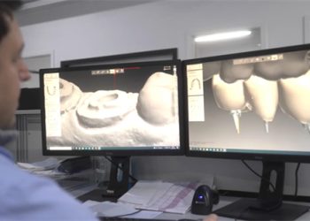 How Do Veneers and Crowns Differ, and Which Option Is Right for You?