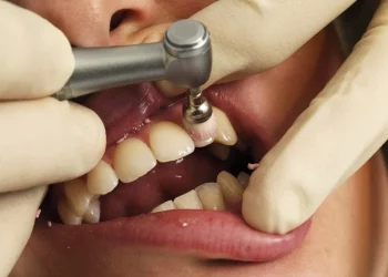 What Foods Are Best for Strengthening Teeth and Preventing Cavities?