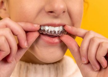 Does Orthodontic Treatment Really Make Your Smile More Confident?