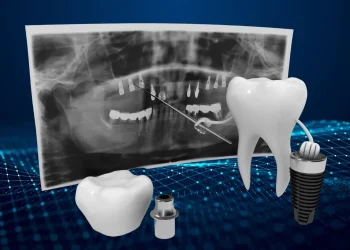 Can Digital Dentistry Improve the Accuracy of Cosmetic Treatments?