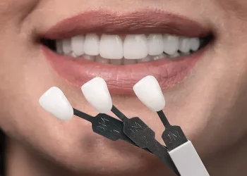 Can 3D Printing Revolutionize the Way We Get Veneers?