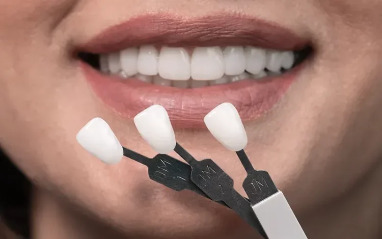 Can 3D Printing Revolutionize the Way We Get Veneers?