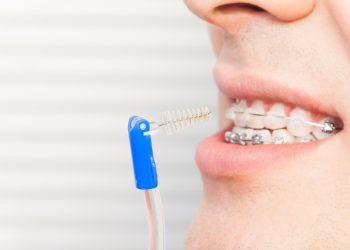 Floss vs. Interdental Brushes: Which Is Better for Your Oral Hygiene?