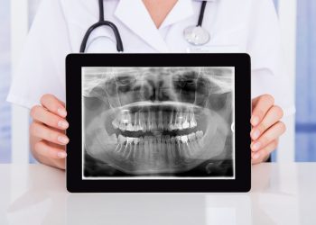 What Are Digital X-Rays? The Benefits of Going Paperless in Dentistry