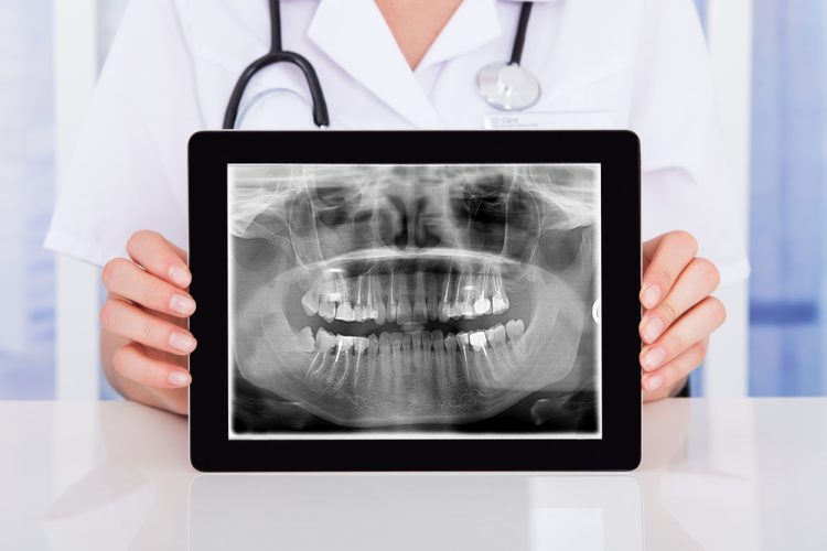 What Are Digital X-Rays? The Benefits of Going Paperless in Dentistry