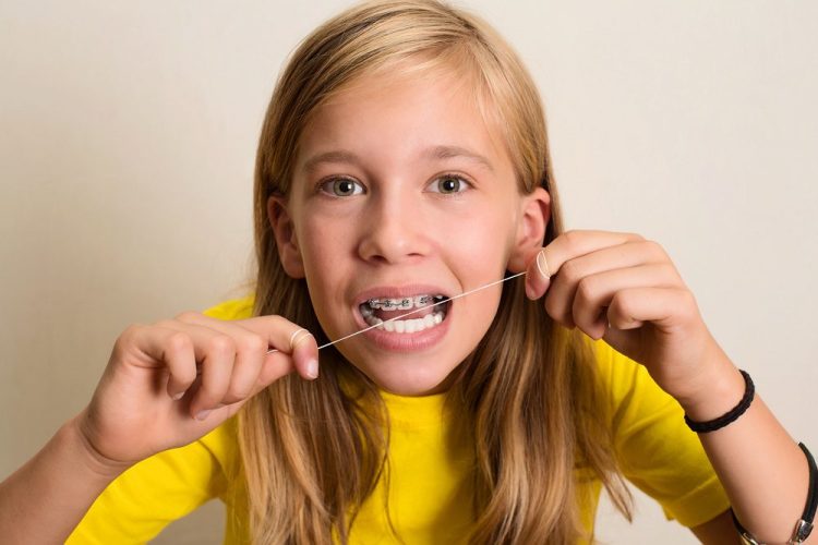 Why Do You Need to Floss Every Day? The Truth Behind This Essential Habit