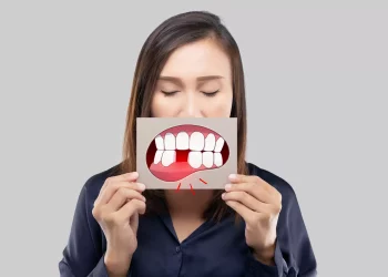 What Are the First Signs of Gum Disease? How to Catch It Early and Prevent Serious Damage