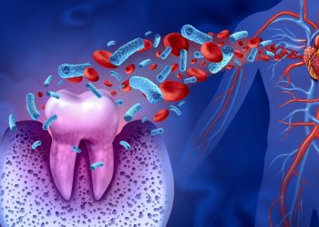 Can Poor Oral Health Lead to Heart Disease? How Your Teeth Are Connected to Your Overall Health