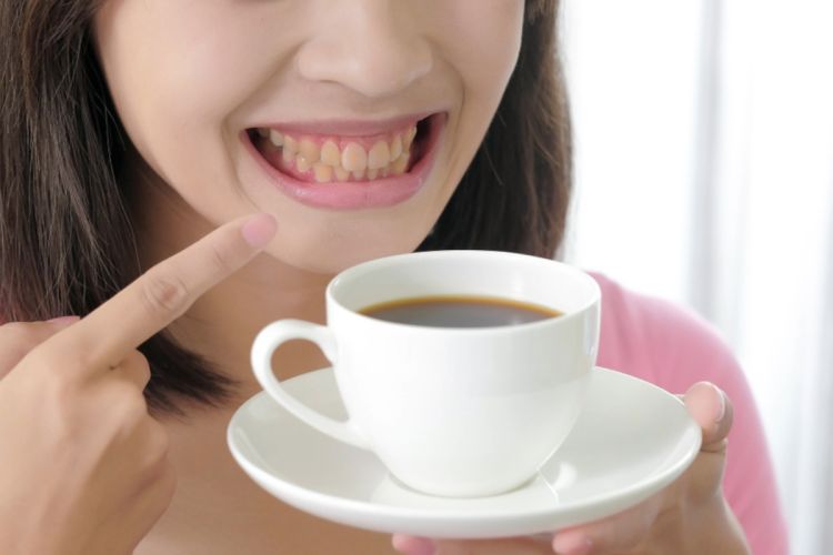 Does Coffee Stain Your Teeth? How to Enjoy Your Favorite Drinks Without Damaging Your Smile