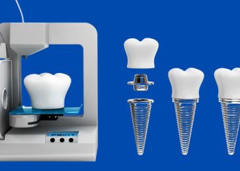 Is 3D Printing the Future of Dentistry? How This Technology is Revolutionizing Smiles