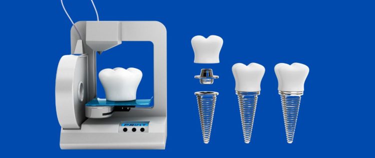 Is 3D Printing the Future of Dentistry? How This Technology is Revolutionizing Smiles