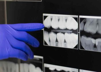 Have You Been Overlooking These Key Habits in Your Dental Care?