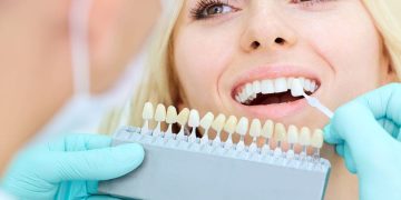 How to Restore a Bright, White Smile with Teeth Whitening Techniques