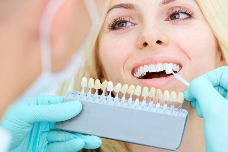 How to Restore a Bright, White Smile with Teeth Whitening Techniques