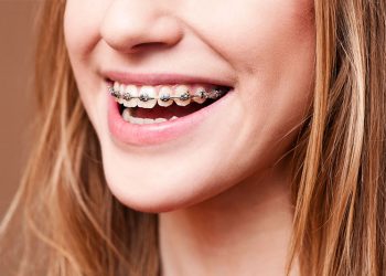 Can Teeth Orthodontics Really Change Your Appearance and Confidence?