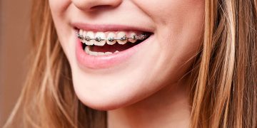 Can Teeth Orthodontics Really Change Your Appearance and Confidence?