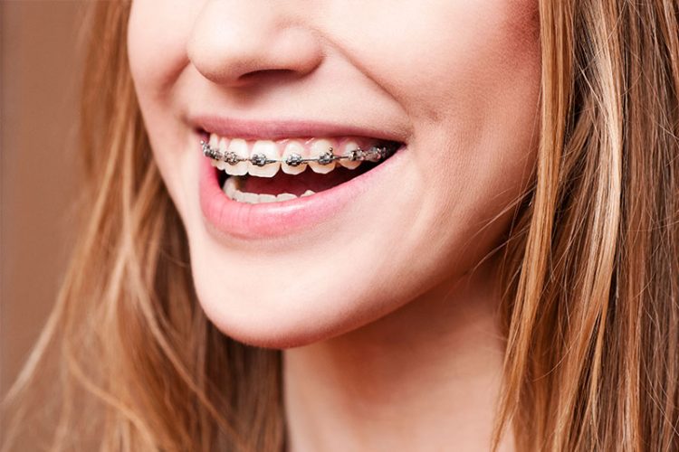 Can Teeth Orthodontics Really Change Your Appearance and Confidence?