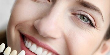 How to Achieve Your Ideal Perfect Smile Through Cosmetic Dentistry Treatments